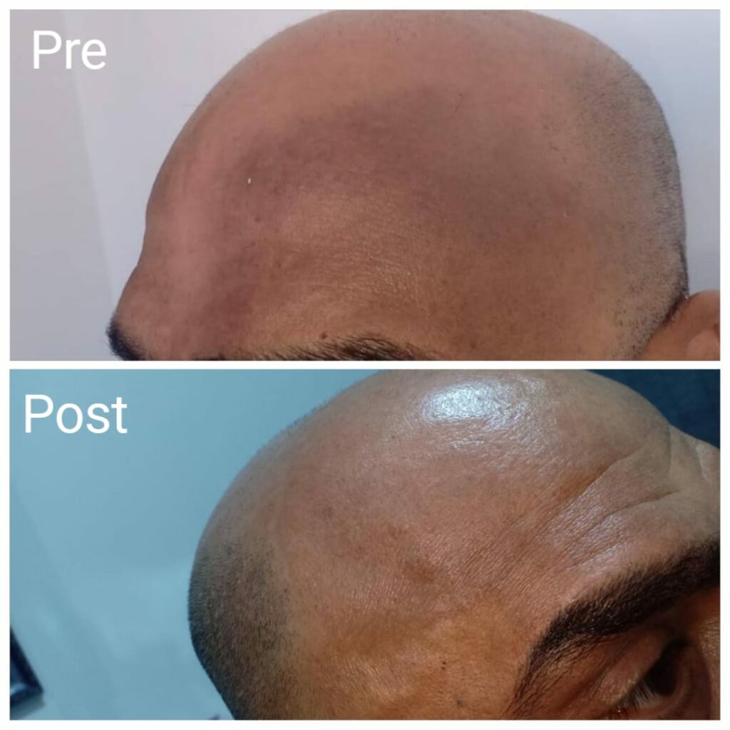 تمتع ببشرة خالية من البقع والتصبغات مع مركز نضارة